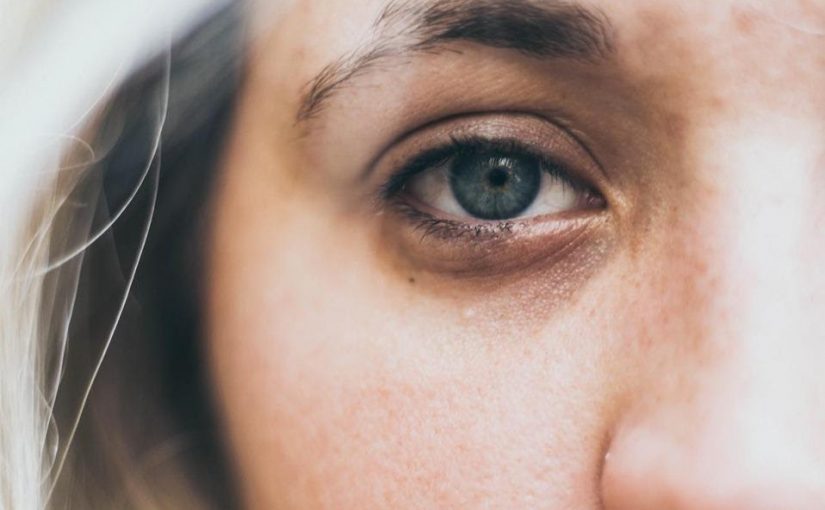 ¿Por qué salen ojeras y cómo pueden ser tratadas?